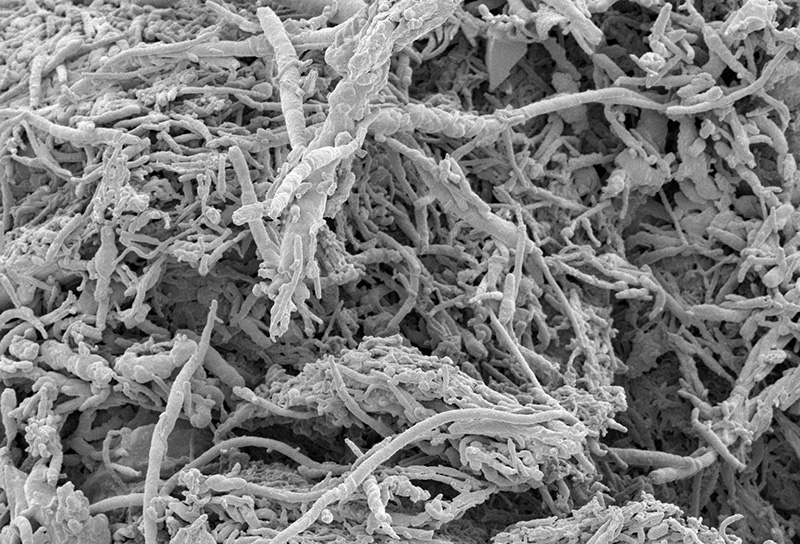 dulkė per mikroskopa